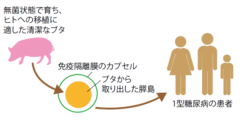 バイオ人工膵島移植の説明